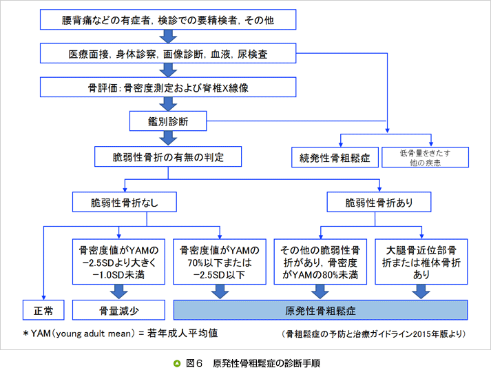 圧迫 骨折 ガイドライン