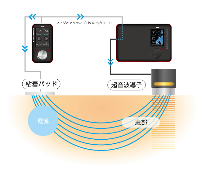 コンビネーション治療って何？ | 酒井医療株式会社