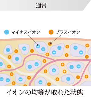 レボックス | 酒井医療株式会社