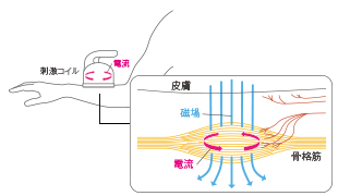 表層の痛覚神経刺激を低減。直接、深部の神経線維にアプローチ。