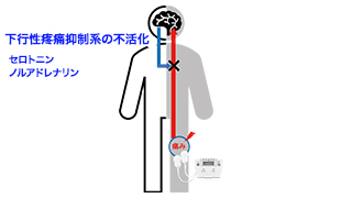 下行性疼痛抑制系を賦活化