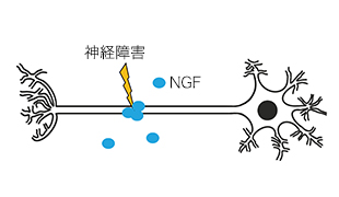 NGFの神経保護作用