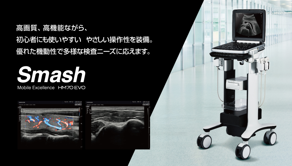 超音波画像診断装置 Smash (HM70 EVO)