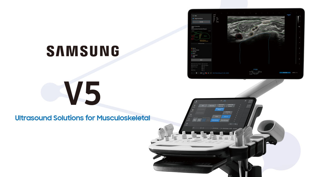 超音波画像診断装置 V5 System