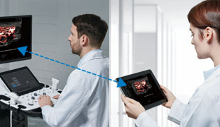 SonoSync™